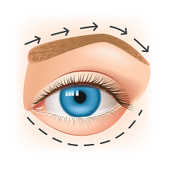 Augenfarbe Andern Kann Man Braune Augen Blau Lasern Lassen Gibt Es Gute Op Verfahren Refraktive Chirurgie