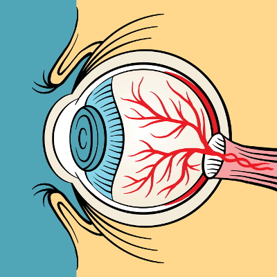 Augenlasern Erfahrungen - Testberichte