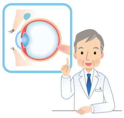 Augenlasern Forum